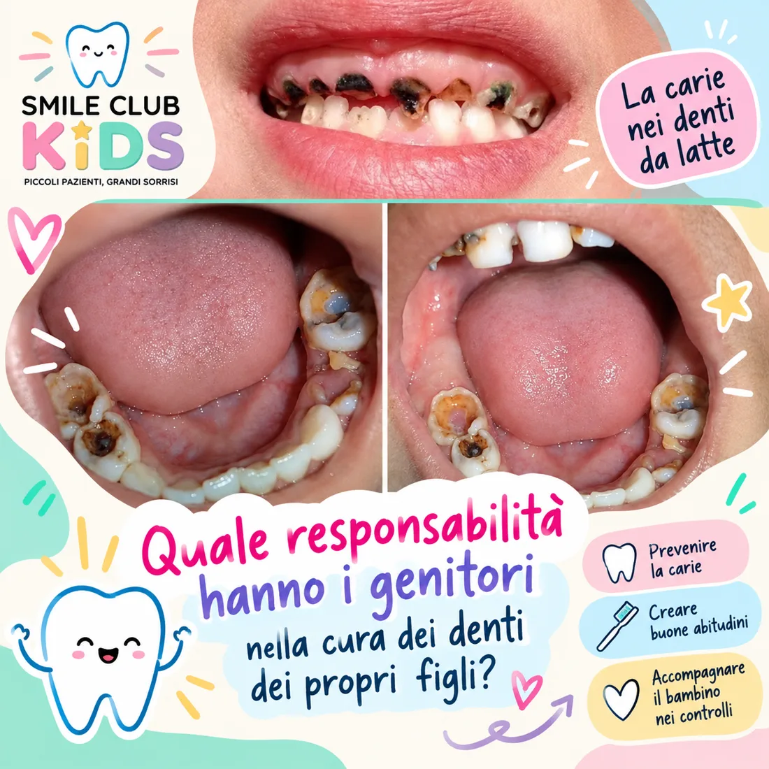 La carie nei denti da latte: quale responsabilità hanno i genitori?